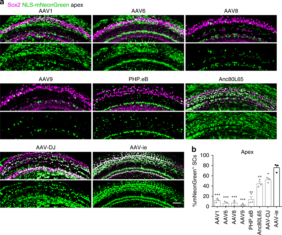 Novel AAV Vector May Lead to Improved Cochlear Therapy