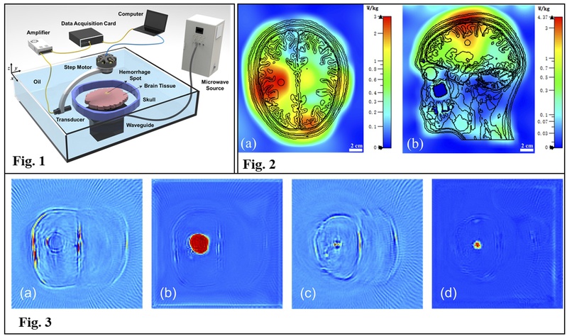 Advances in Deep-Learning-Enabled Microwave-Induced Thermoacoustic Tomography by SIST  