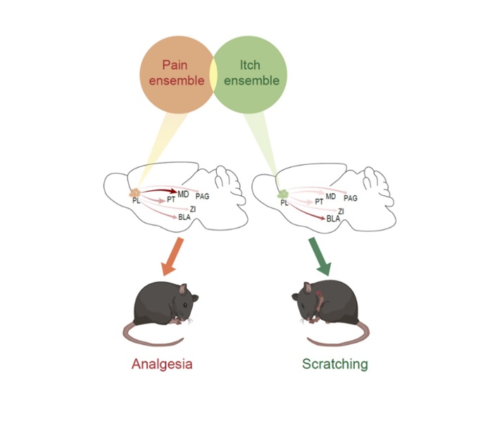 How pain and itch are differentiated: A new neural mechanism revealed by life science researchers