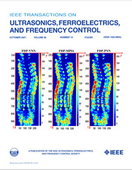 New algorithm speeds up 3D ultrasound spine imaging