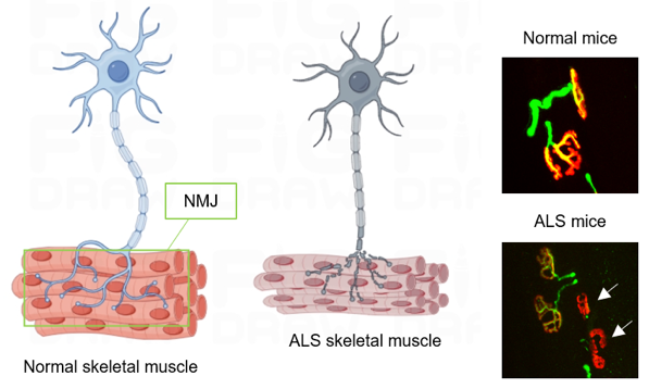 A novel potential antibody-based therapy for ALS