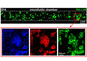 HiPSCs Microfluidic Reprogramming Success Advances Clinical Application