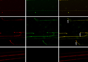 Mechanism Advances Fight Against TB-Drug Resistance 