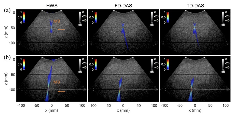 A fast beamforming method for monitoring cavitation-based focused ultrasound therapies   