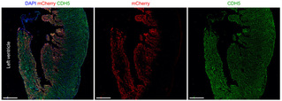 SLST Researchers Propose a Potential Strategy to Treat Myocardial Infarction