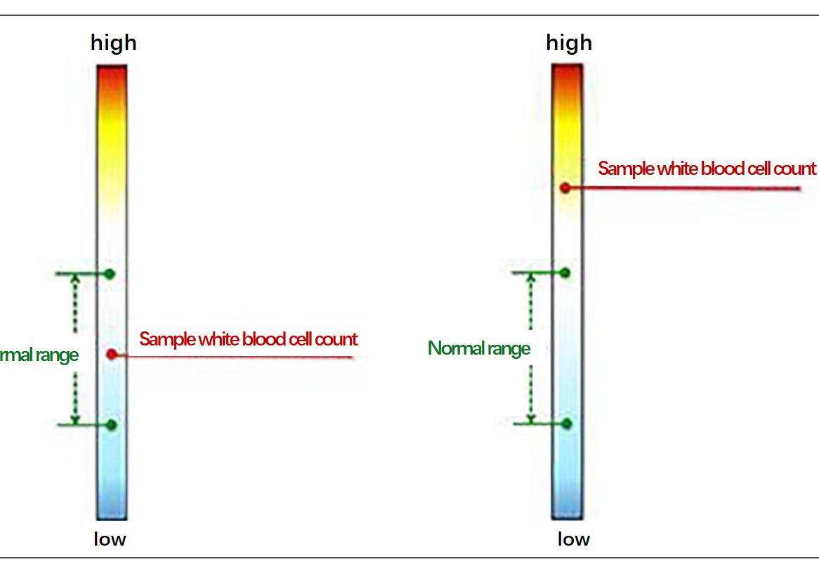 Progression Bias Found to Be A Key Part of Decision Making