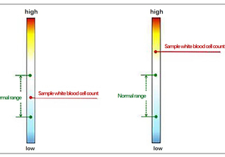 Progression Bias Found to Be A Key Part of Decision Making