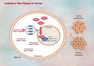 Groundbreaking Study Offers New Entry Point in Triple Negative Breast Cancer Research